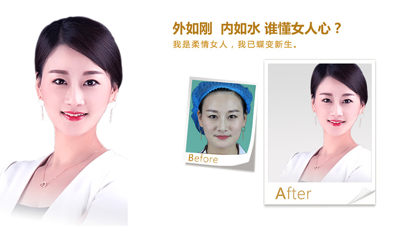 锦州V脸、线雕隆鼻